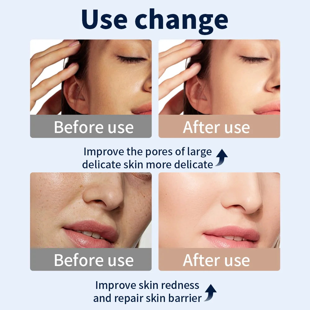 Glowby™ Light Therapy Mask