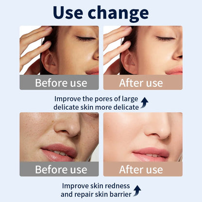 Glowby™ Light Therapy Mask