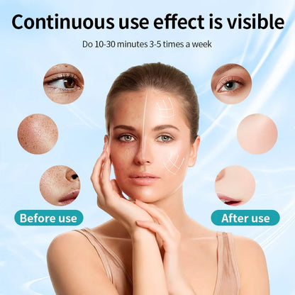 Glowby™ Light Therapy Mask